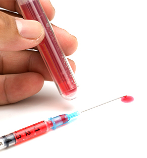 Anaemia Profile