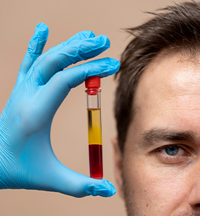 Lipid Profile